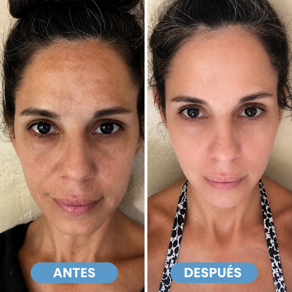 BARUBT — Elimina manchas desde la raíz