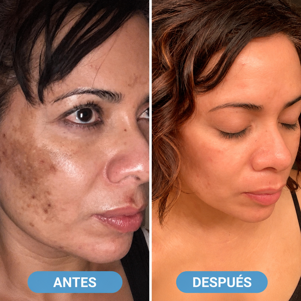 BARUBT — Elimina manchas desde la raíz